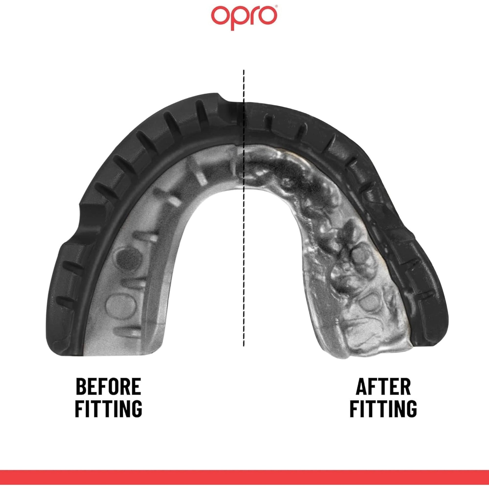 OPRO Gold Level Mouthguard for Braces, Adults Sports Mouth Guard, Featuring Revolutionary Fitting Technology for Boxing, Lacrosse, MMA, Martial Arts, Hockey, and All Contact Sports